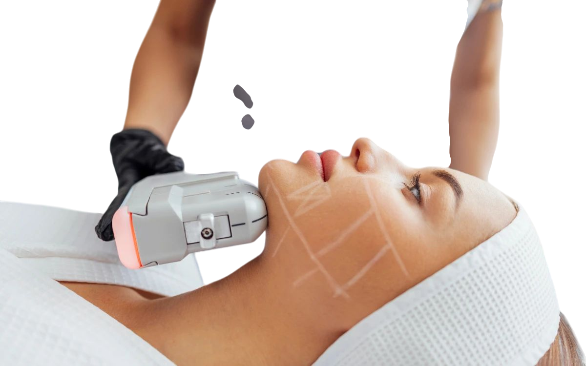 Profesional aplicando un tratamiento facial con equipo HIFU